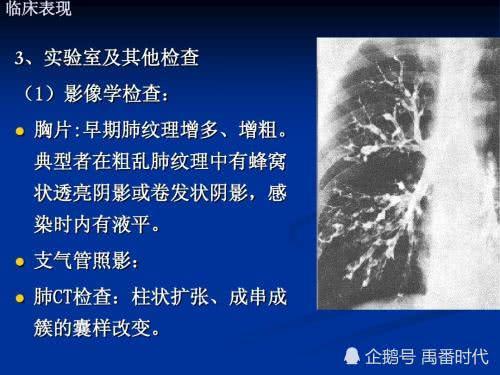 支气管扩张怎样养生更有利于巩固疗效